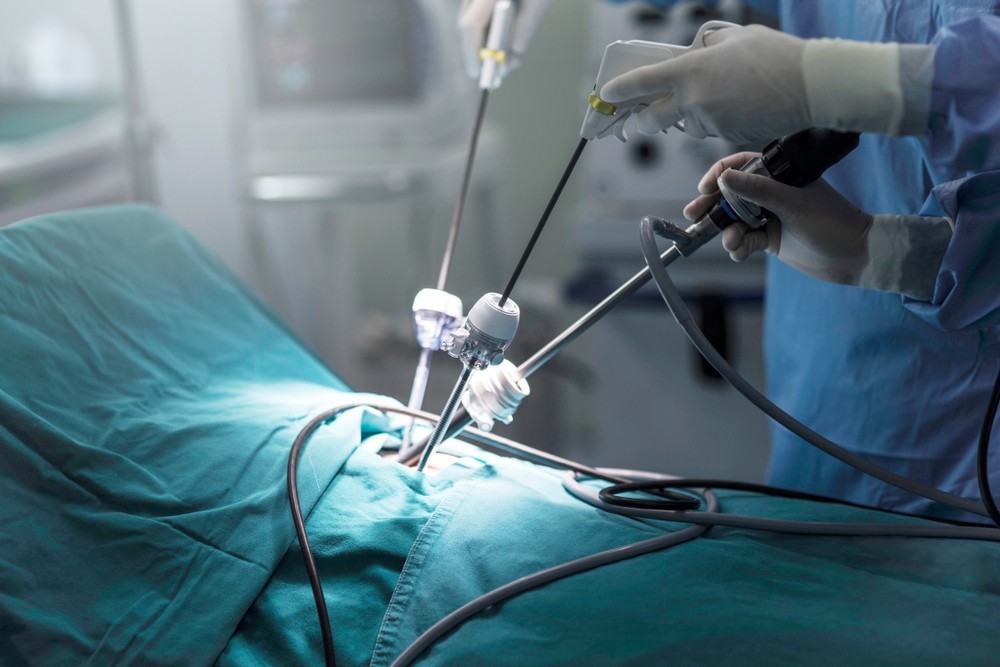 Minimally Invasive Brain Surgeries by Dr. Alok Srivastava
