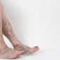 why do varicose veins develop 85x85